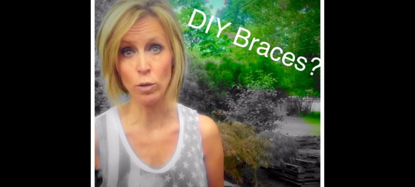 DIY Braces Cheap Beauty Trend Kills Teeth: Anastasia's Hump Day Happenings