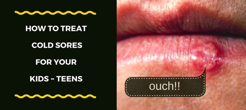 How To Treat Your Child's Cold&nbsp;Sore